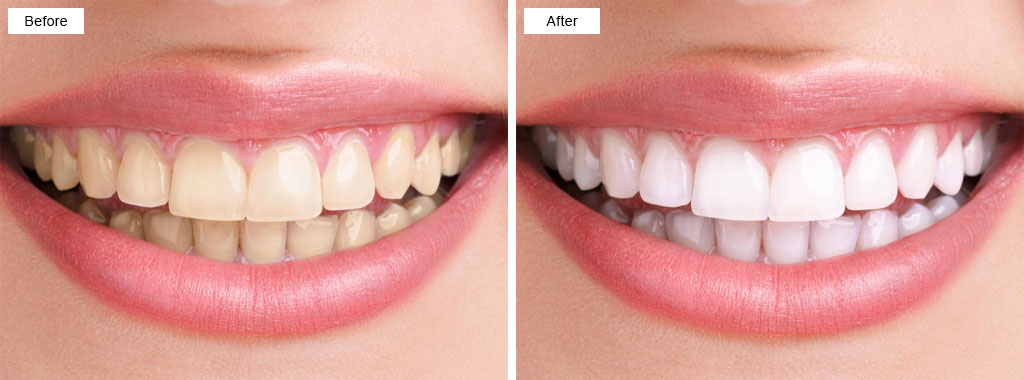 Limestone Coast Dental Portfolio 7