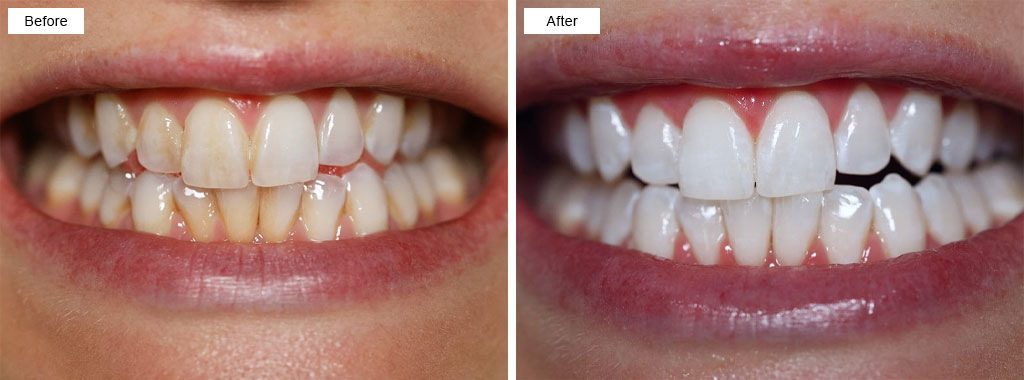 Limestone Coast Dental Portfolio 6